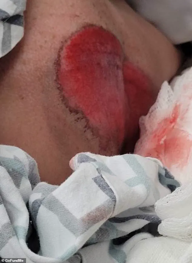 Backpack Saves Girl’s Life in Wisconsin Traffic Incident