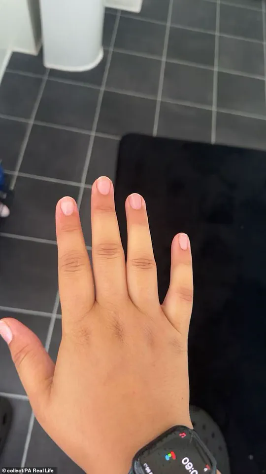 Tia Rey Diagnosed with Rare Autoimmune Disease: Anti-Synthetase Syndrome Affects 1 in 100,000