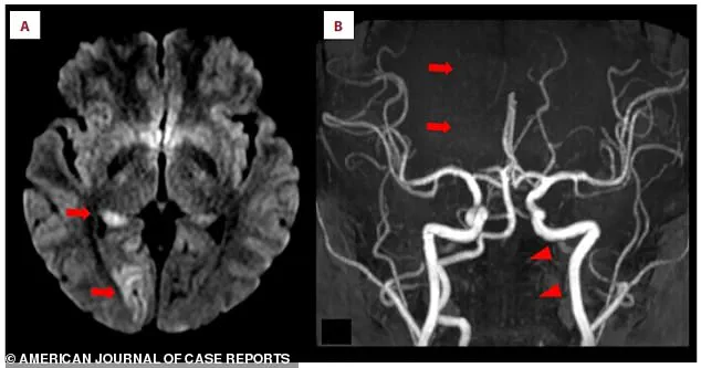 Stroke Linked to Nintendo Ring Fit Adventure Sparks Debate on Fitness Game Safety