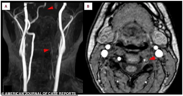 Stroke Linked to Nintendo Ring Fit Adventure Sparks Debate on Fitness Game Safety