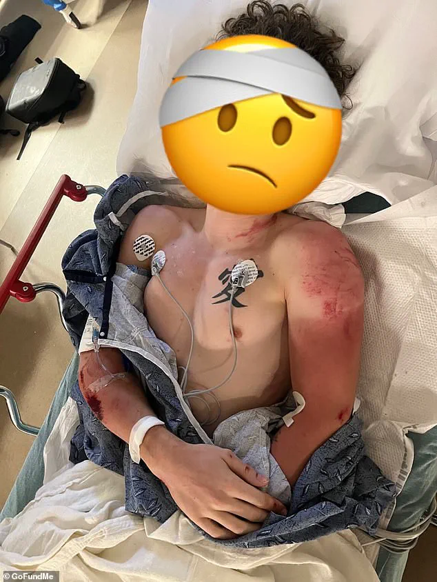 Viral Footage Sparks Outcry After Georgia Motorcyclist Critically Injured in Police Pursuit Collision