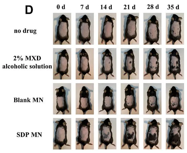 Breakthrough Study Reveals Stevia May Boost Hair Growth When Combined with Minoxidil