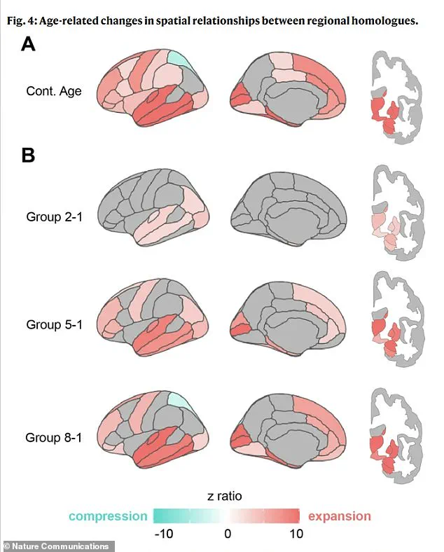 Groundbreaking Link Found Between Brain Shape Changes and Early Dementia Signs, Challenging Traditional Aging Studies