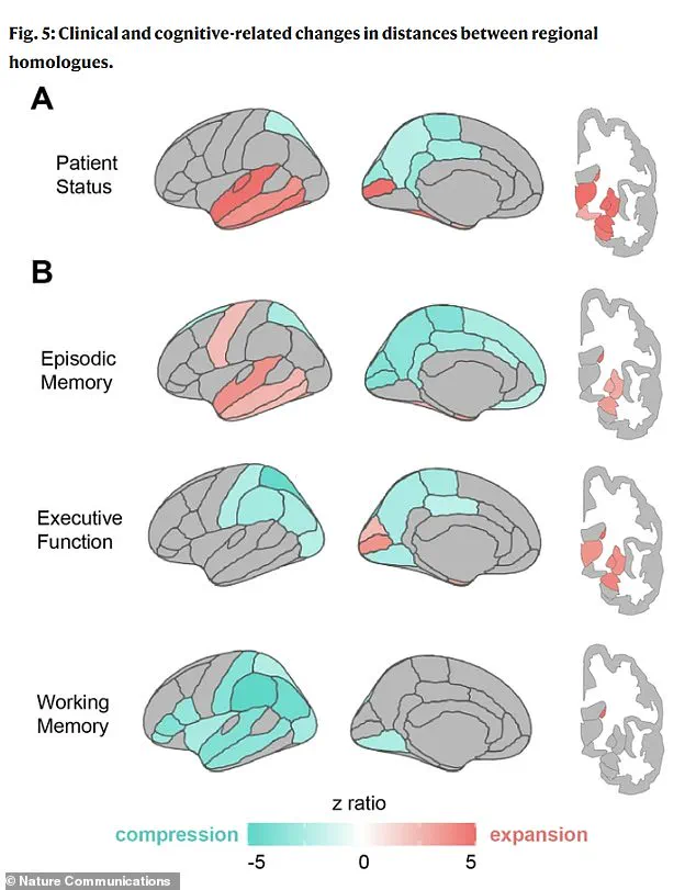 Groundbreaking Link Found Between Brain Shape Changes and Early Dementia Signs, Challenging Traditional Aging Studies