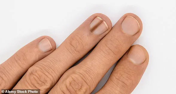 Health Experts Urge Immediate Action: Early Body Signals May Signal Serious Illness