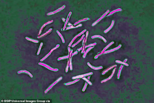 UK Health Officials Warn of TB Surge After New Data Shows 13.6% Increase