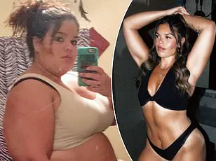 Exclusive Access: The Journey to Gastric Sleeve Surgery