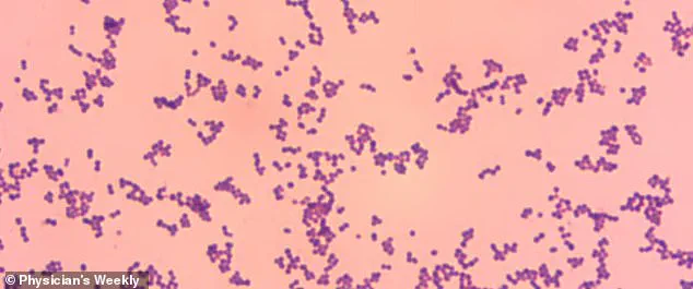 Exclusive Insight: Rare Case Reveals Hidden Dangers of Common Skin Bacteria