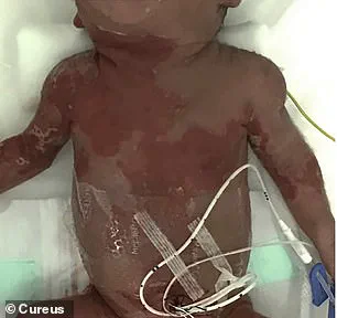 Silent Herpes Infections and Prenatal Care: A Wake-Up Call for Public Health Regulations