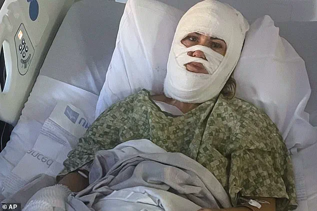 Georgia Woman's Acid Attack Sparks Urgent Call for Justice as Community Reels from Shocking Incident