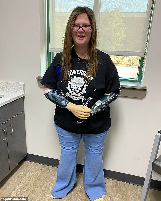 Mother of Four Loses All Limbs After Septic Shock from Flu