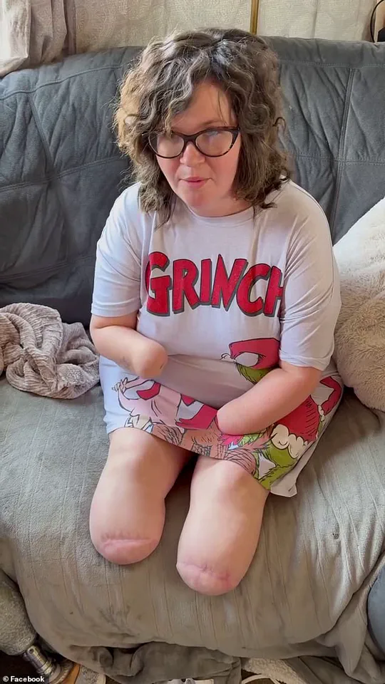 Mother of Four Loses All Limbs After Septic Shock from Flu