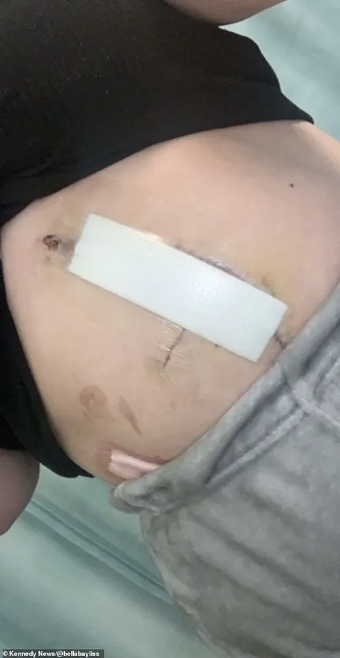 Bella Bayliss's Medical Emergency: Unaddressed Symptoms at Gloucestershire Royal Hospital