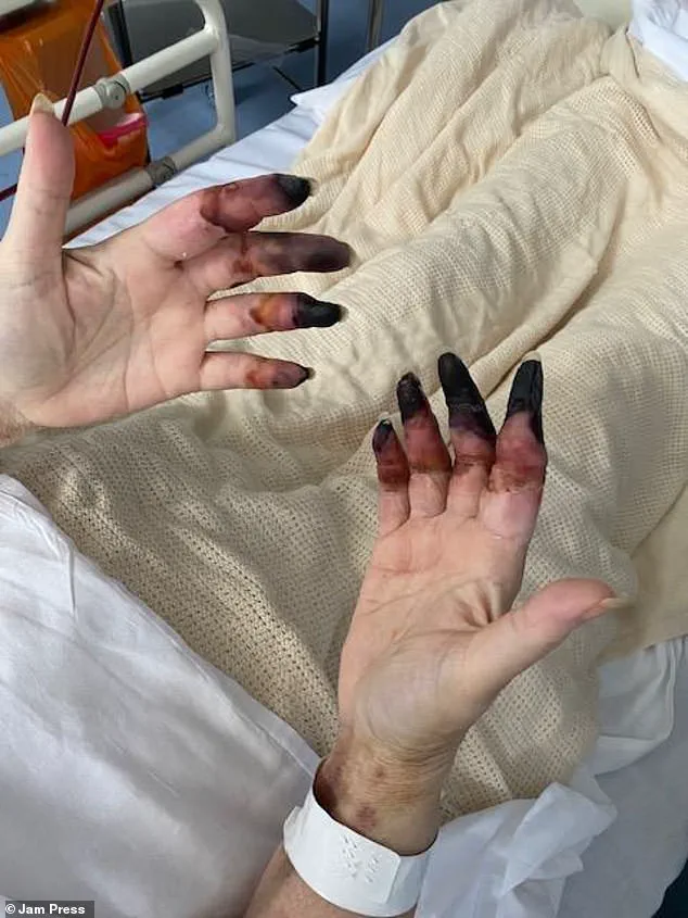 Misdiagnosis Leads to Harrowing Situation for Woman with Kidney Stone Symptoms