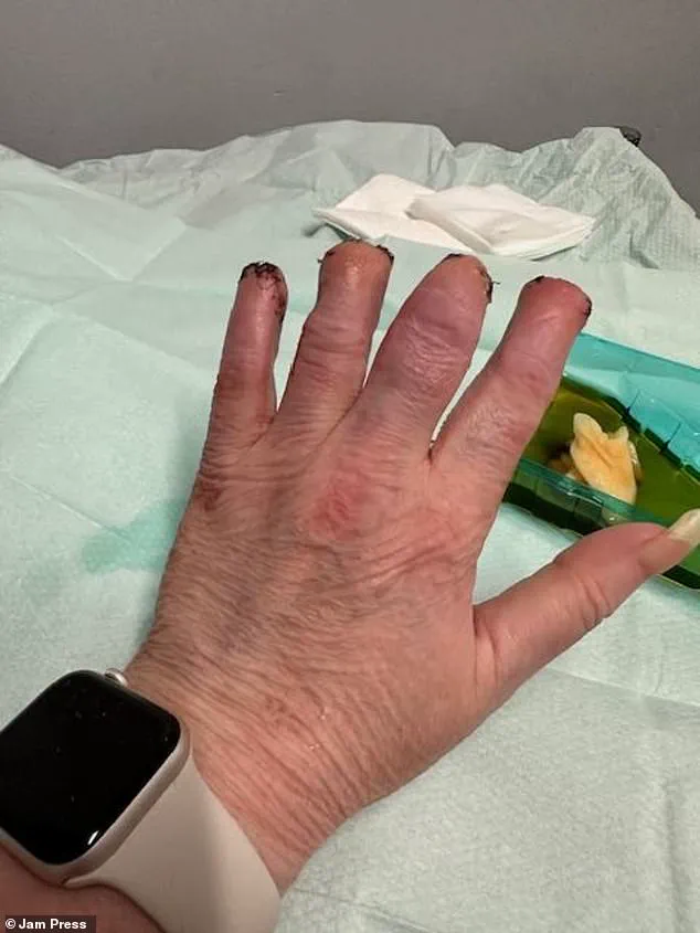 Misdiagnosis Leads to Harrowing Situation for Woman with Kidney Stone Symptoms