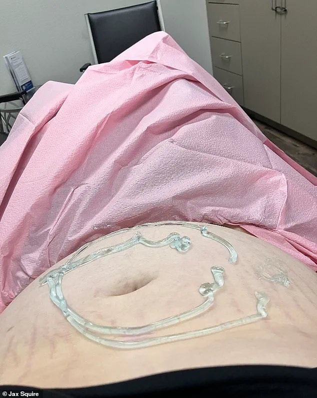 Jax Squire's Journey: A Transgender Man's Decision to Give Up His Baby and the National Conversation on Identity and Parenthood