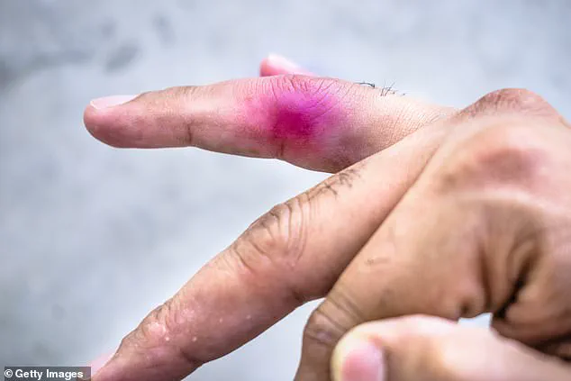 Nine-Year-Old Sues 11-Year-Old Peer Over Alleged Injury During Make-Believe Game at Daycare