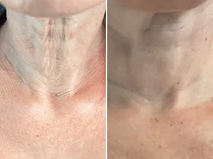 Government Regulations Aim to Address Public Misconceptions About Rapid Weight-Loss Medications