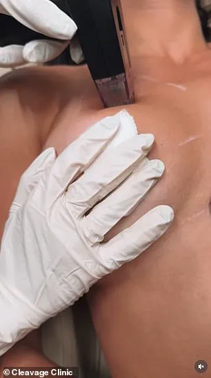 The Cleavage Clinic Provides Non-Invasive Breast Enhancement in Midtown Manhattan