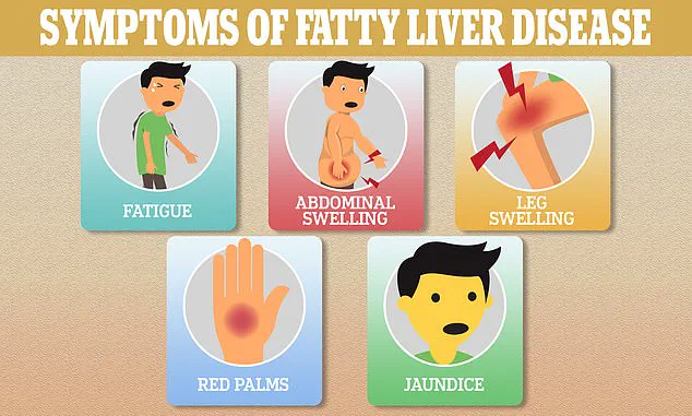 Fatty Liver Disease: A Silent Global Epidemic Driven by Modern Lifestyle Factors