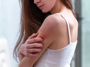 Urgent Alert: Discontinuation of Peanut Allergy Treatment Palforzia Sparks Health Expert Warnings and Public Concern