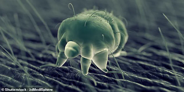 Persistent Itch Initially Misdiagnosed as Allergy Requires Further Medical Evaluation