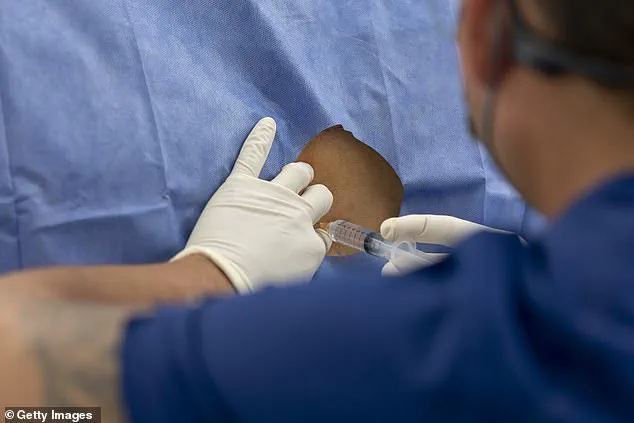 Breakthrough Gel for Chronic Back Pain Linked to Acne Bacteria Cuts Opioid Use by Half