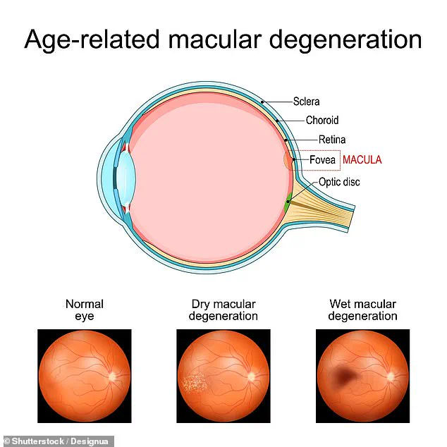 Breakthrough Study: Diabetes Drug Metformin Linked to 37% Lower Risk of Age-Related Macular Degeneration