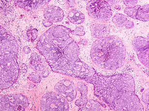 A Dog's Odd Behavior Leads Attorney Chase Johnson to Experimental Breast Cancer Vaccine Trial