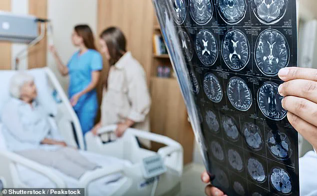 Gut Microbiome Transfer of Alzheimer's Symptoms Unveiled: Dietary Influence on Prevention