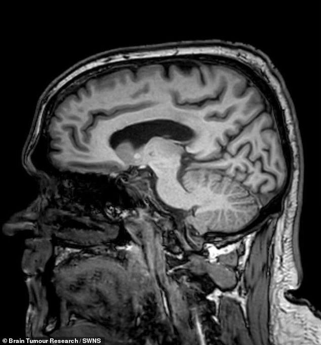 From Misdiagnosed Fatigue to Brain Tumor: A Systemic Failure in Healthcare