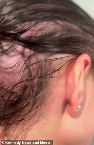 Mystery Illness Unveiled: Leaky Air-Conditioning Unit Reveals Unexpected Trigger in Mercedes Brooke's Health Struggle