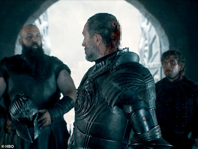 Prince Baelor Targaryen's Fatal Trial-By-Combat: Medical Experts Analyze Trauma's Plausibility In Medieval Setting