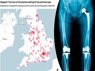 University of Bristol's Smart Shoes: A Game-Changer in Preventing Elderly Falls and Reducing NHS Burden