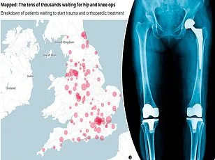 University of Bristol's Smart Shoes: A Game-Changer in Preventing Elderly Falls and Reducing NHS Burden