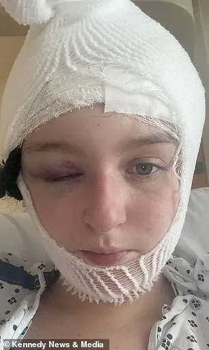 Benign Brain Tumor Shocks 21-Year-Old After Misdiagnosis of Stress Headaches