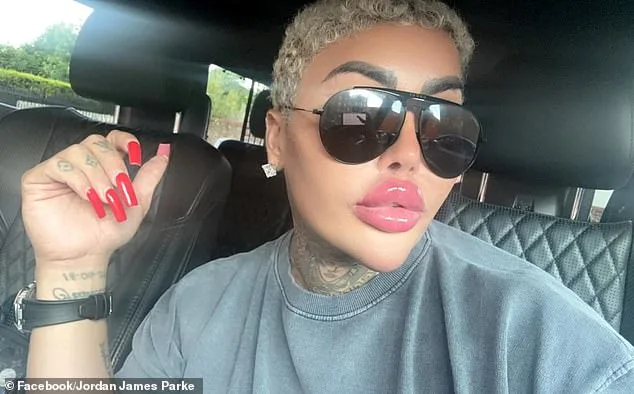 Arrests Made in Death of 'Lip King' Jordan James Parke; Police Investigate Cosmetic Procedure Link