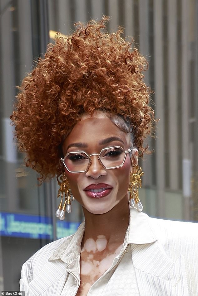 NHS Approves Groundbreaking Cream to Restore Skin Color for Vitiligo Patients