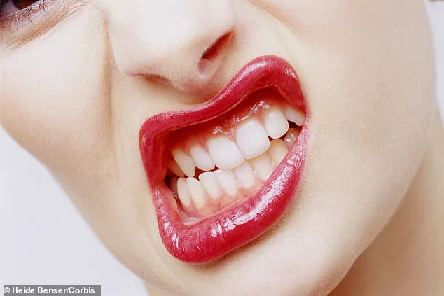 The Silent Epidemic: How Bruxism's Hidden Toll Harms Health and Quality of Life