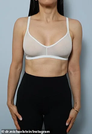 A Quiet Revolution: Natural Breast Aesthetics Reshape Beauty Standards