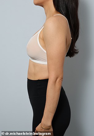 A Quiet Revolution: Natural Breast Aesthetics Reshape Beauty Standards