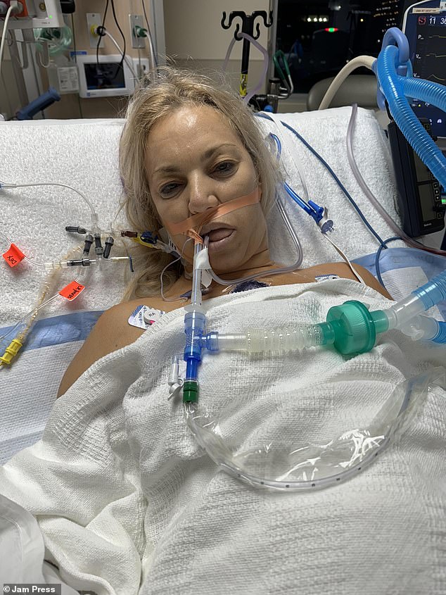 From Empowering Choice to Chronic Pain: How Breast Implants Triggered Hip Arthritis and a Life of Suffering