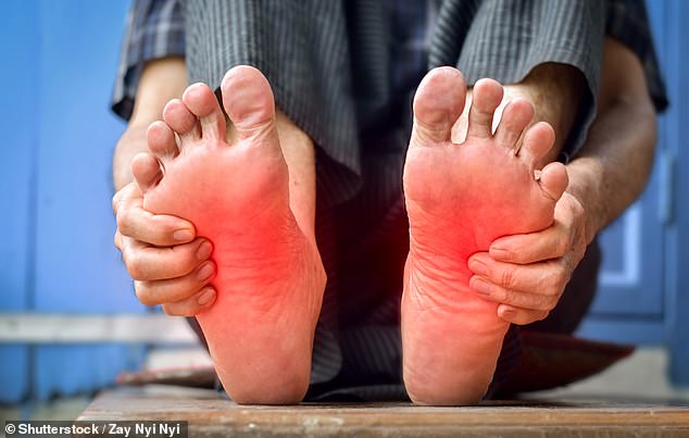 Burning Feet and Peripheral Neuropathy: Diabetes and Thyroid Disorders as Common Causes