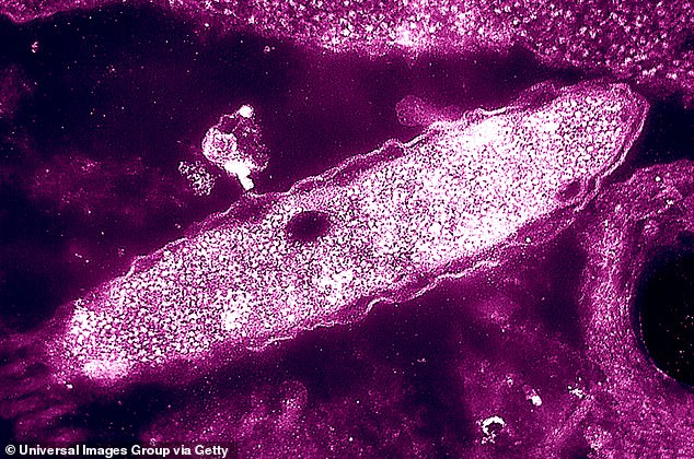 Legionnaires' Disease Spike in London's North and South West Sparks UKHSA Investigation Over Legionella Risk