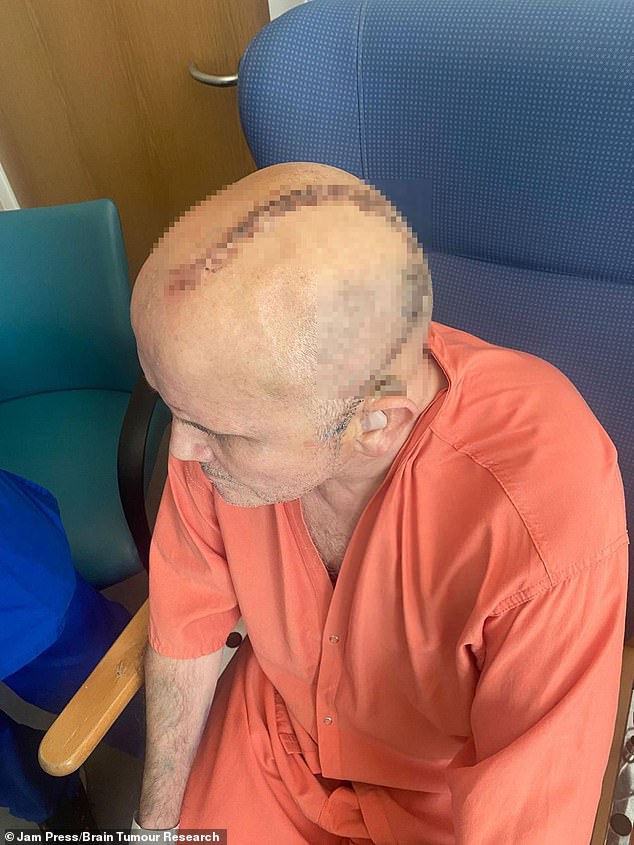 A 62-Year-Old Man's Sudden Illness Reveals Hidden Brain Tumor