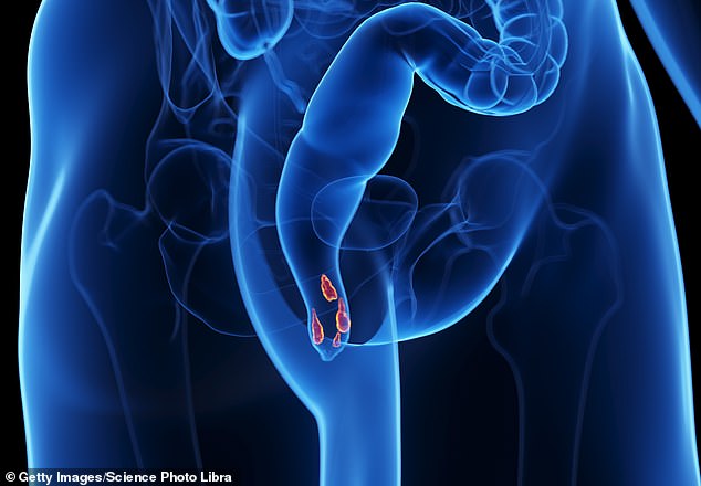 Shattered Silence: The Unseen Battle with Hemorrhoids and the Journey to Relief