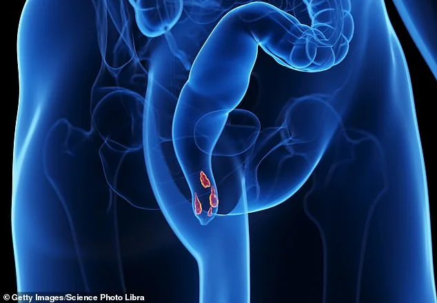 Shattered Silence: The Unseen Battle with Hemorrhoids and the Journey to Relief