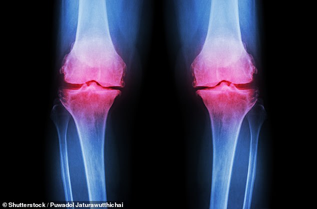 Low-Cost Fibre Supplement Offers Breakthrough in Treating Knee Osteoarthritis Pain, Study Reveals