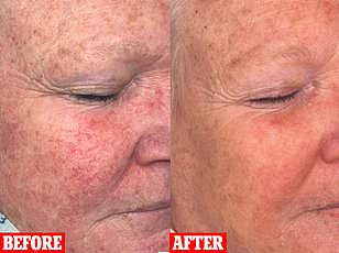 Skin Deep: The Hidden Crisis Beneath Our Surface