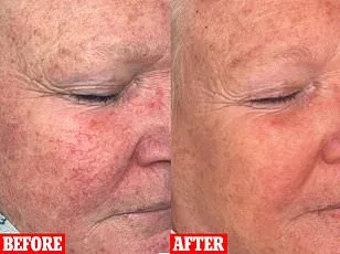 Skin Deep: The Hidden Crisis Beneath Our Surface